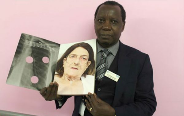 Dr Max with the Black Country lungs book